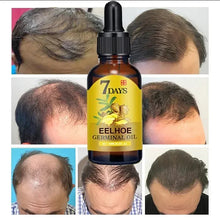 Load image into Gallery viewer, 7 Day Fast Hair Growth Oil Ginger Growth Hair Treatment Anti Hair Loss Men Women Scalp Treatment Serum Products Beauty Product