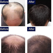 Load image into Gallery viewer, 7 Day Fast Hair Growth Oil Ginger Growth Hair Treatment Anti Hair Loss Men Women Scalp Treatment Serum Products Beauty Product