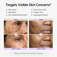 Load image into Gallery viewer, Face &amp; Body Serum for Dark Spots