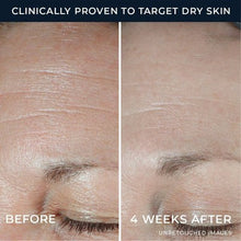 Load image into Gallery viewer, RoC Multi Correxion Hydration Night Moisturizer 1.7oz - Imperfect Box