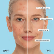 Load image into Gallery viewer, Glycolic Acid Pads 200 PCS