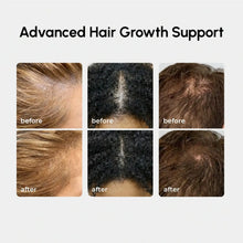 Load image into Gallery viewer, 4-in-1 Hair Growth Spray