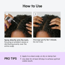 Load image into Gallery viewer, 4-in-1 Hair Growth Spray