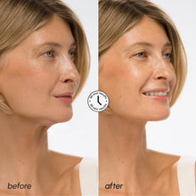 Load image into Gallery viewer, Hyaluronic Acid V-line Lifting Mask