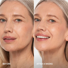 Load image into Gallery viewer, Pro-Retinol Neck Lifting Cream Massager