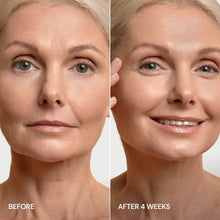 Load image into Gallery viewer, Pro-Retinol Neck Lifting Cream Massager
