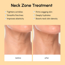 Load image into Gallery viewer, Lifting Neck Wrinkle Patches