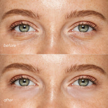 Load image into Gallery viewer, Pink Eye Patches for Puffy Eyes