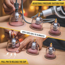 Load image into Gallery viewer, Professional Biomagnetic Cupping Therapy Set – 18 Massage Cups with Magnetic Therapy