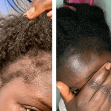 Load image into Gallery viewer, Mega Ayurvedic Hair Oil